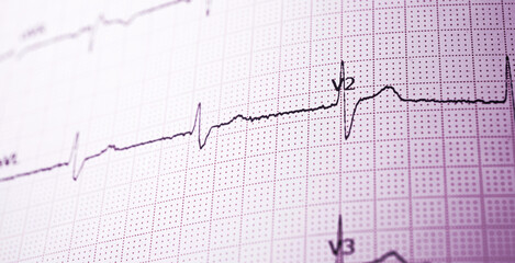 Electrocardiograph closeup view