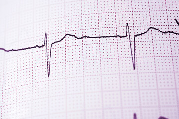 Electrocardiograph closeup view