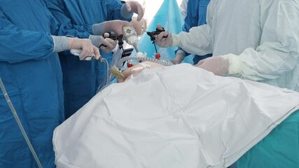 The hands of surgeons in latex gloves and blue uniforms hold special medical instruments during laparoscopic minimally invasive surgery. Treatment of proctological diseases.