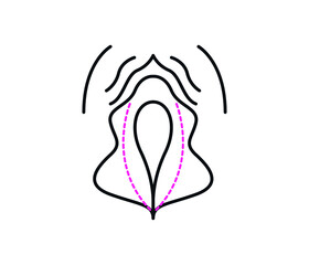 vector vagina plastic surgery concept. medical operation Gynecology. Isolated illustration.
