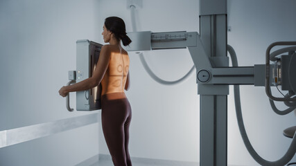 Hospital Radiology Room: Beautiful Multiethnic Woman Standing Topless in the X-Ray Machine. Adult...