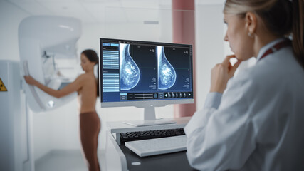 Obraz na płótnie Canvas Computer Screen in Hospital Radiology Room: Beautiful Multiethnic Adult Woman Standing Topless Undergoing Mammography Screening Procedure. Screen Showing the Mammogram Scans of Dense Breast Tissues.