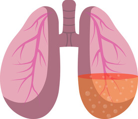 Drawing about sick human lungs. Sputum in the lungs. Drawing in flat design.