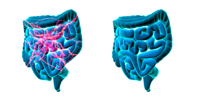 Stomach pain and abdominal pain, visualizing stabbing pain and the small and large intestine without pain, 3d illustration
