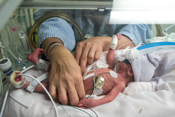 Mother caring premature newborn baby in incubator
