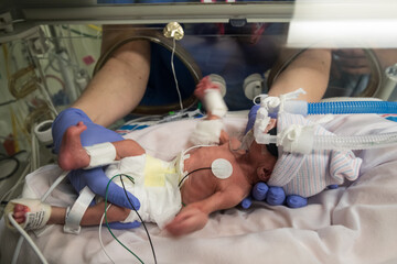 Nurse caring premature newborn baby in incubator
