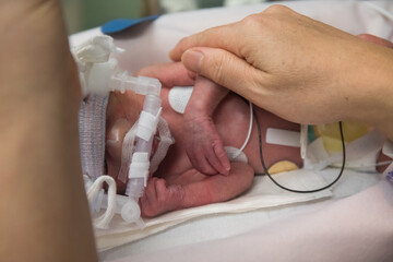 Mother touching premature newborn baby in incubator