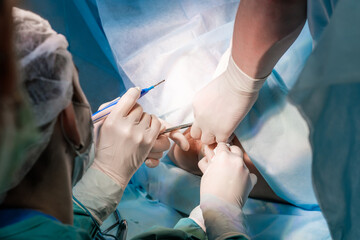 The surgeon holds the electrical coagulator during proctological surgery on the anus. Close-up - hands covered with blood in sterile gloves. Minimally invasive surgery. Blue uniform and medical masks.