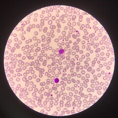 Lymphocyte.