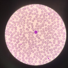 Lymphocyte.