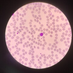 Lymphocyte.