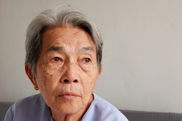 Face focus of Elderly Asian woman with grey hair and freckles and wrinkled skin and eye is cataract or pterygium, Aging society and Various illnesses of the elderly and good health concept