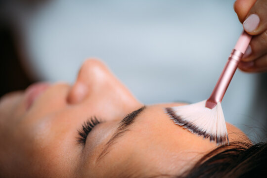 TCA Chemical Peel Treatment.
