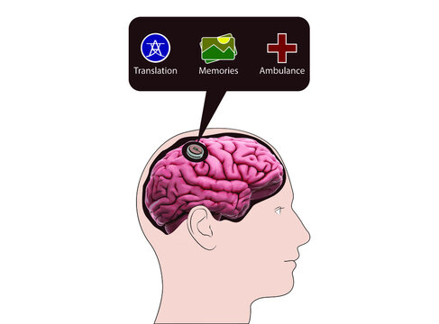 Implant a chip in the brain, neuralink
