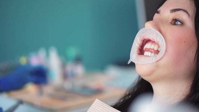 Close-up process of brushing teeth in dental clinic. A professional dentist treats teeth with a special instrument for female patient. Working process in dentistry. Healthcare and medicine concept.