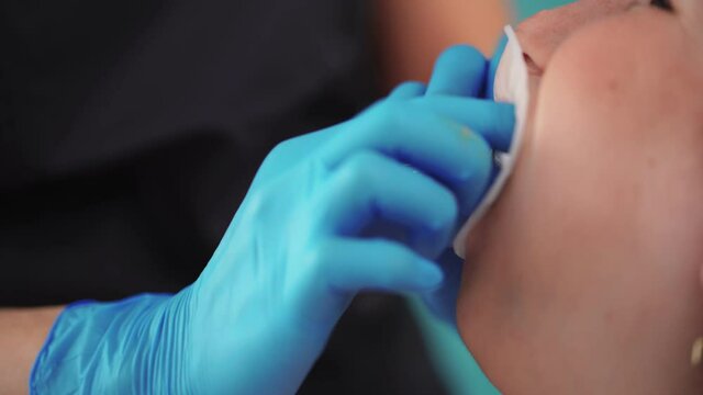 Close-up of a professional dentist placing a special mouth guard in a woman's mouth at a dental clinic. Working process in dentistry. Healthcare and medicine concept.