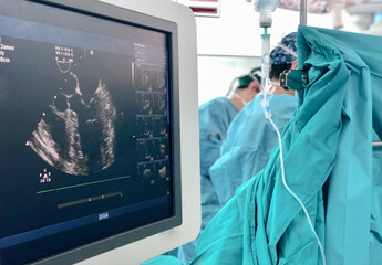 Transesophageal Echocardiography (TEE) during open heart surgery.