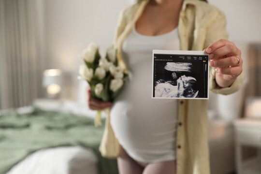 Young pregnant woman with flowers at home, focus on ultrasound picture of baby. Space for text