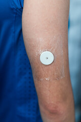 Blutzucker messen f&uuml;r Diabetes