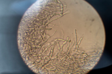 hongo visto a través del microscopio