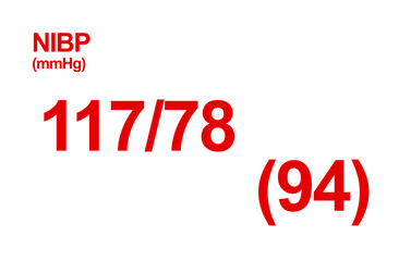 Non-invasive blood pressure(NIBP) monitor screen. Monitoring NIBP at the Hospital
