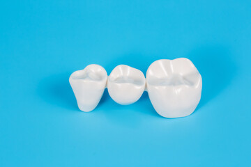 Dental crowns, imitation of a dental prosthesis of a dental bridge