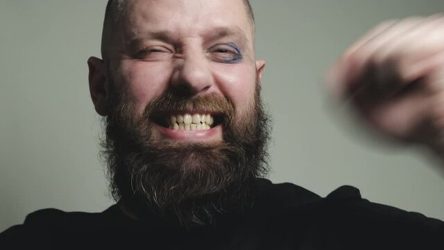 A funny crazy middle-aged man with a beard and a black eye is celebrating a happy event. Caucasian bald madman with clenched fists shows positive emotions. The concept of victory