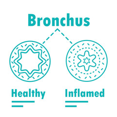 bronchus disease infographic