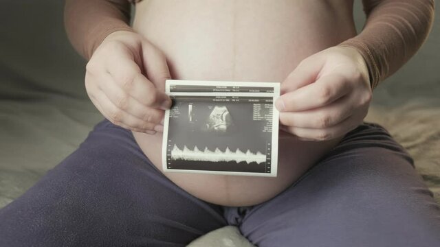 pregnant tummy and female hands holding sonogram image of healthy unborn baby