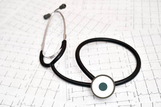 Stethoscope on the cardiogram charts in a paper form as a background. Selective focus. Health care and medical concept.
