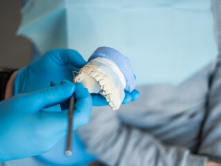 The dentist holds a plaster cast of the jaw. Blue gloves.