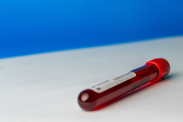 tubo de sangre Close up