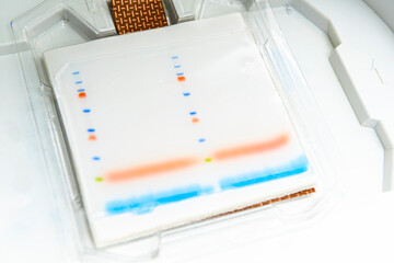 Western blotting, protein blotting: the transfer of proteins that have been separated by gel...