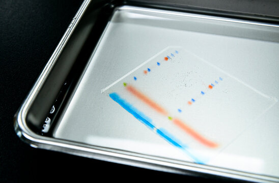 Polyacrylamide gel including separated protein ladder markers and protein samples on stainless steel tray