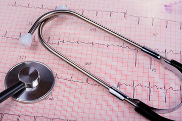 ECG graph with heart diagnose and stethoscope