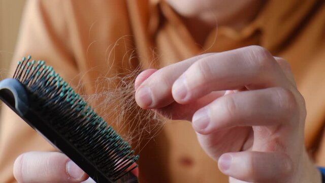 Hair loss. Frustrated man with comb full of falling hair