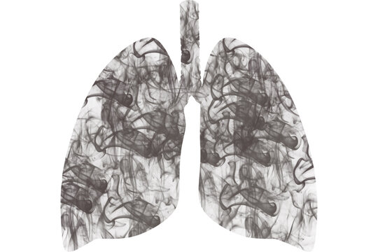 Lungs of a sick person smoker. Lungs' cancer. Health problems.