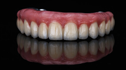 great photo of a ceramic dental prosthesis of the upper jaw on black glass with a creative reflection © Dental Pro Content