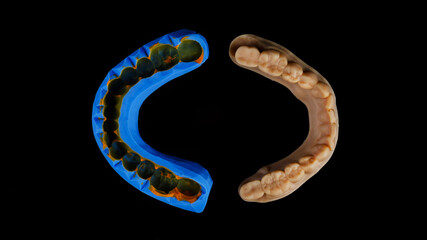 composition of dental model and impression made of silicone, top view on a black background