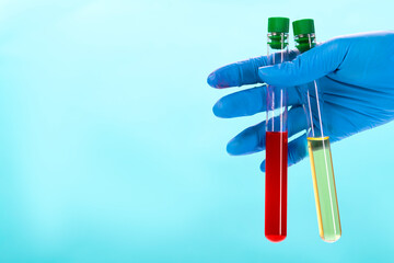 Blood test with analysis of a urine sample. Urine and blood test tubes in hand, healthcare and...