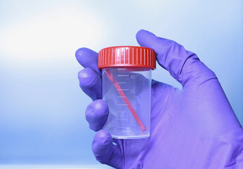 Biomaterial container with milliliter scale in doctors hand. Closed transparent sterile medical...