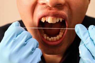 デンタルフロスで歯の隙間を掃除する人物