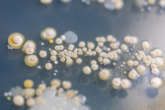 Mold Beautiful, Colony of Characteristics of Fungus (Mold) in culture medium plate from laboratory microbiology.
