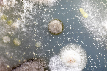 Mold Beautiful, Colony of Characteristics of Fungus (Mold) in culture medium plate from laboratory...