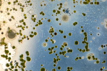 Mold Beautiful, Colony of Characteristics of Fungus (Mold) in culture medium plate from laboratory microbiology.

