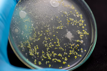 Mold Beautiful, Colony of Characteristics of Fungus (Mold) in culture medium plate from laboratory microbiology.

