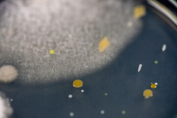 Mold Beautiful, Colony of Characteristics of Fungus (Mold) in culture medium plate from laboratory microbiology.
