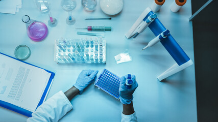 Top Down View of a Medical Research Scientist in Blue Rubber Gloves Working with Micropipette...