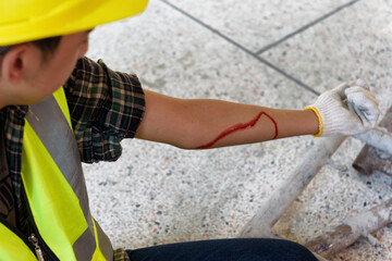 Injury bleeding from work accident in pile of scaffolding steel falling down to impinge the arm of...