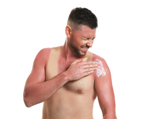 Naklejka premium Man applying cream on sunburn against white background